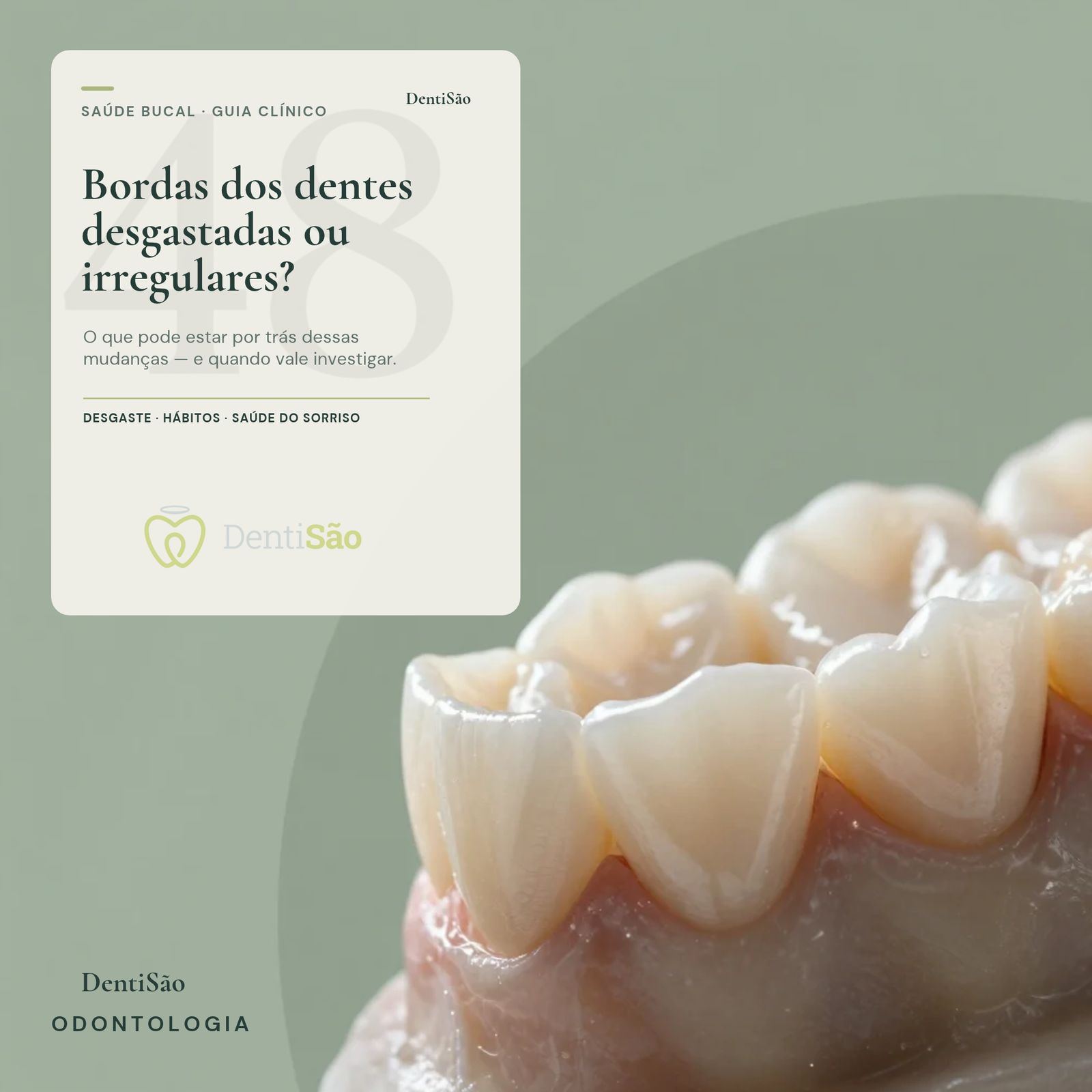 Bordas dos dentes desgastadas ou irregulares: o que pode estar por trás dessas mudanças?
